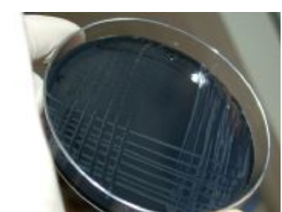 Gıdalarda Campylobacter aranması Gıdalarda Campylobacter aranması