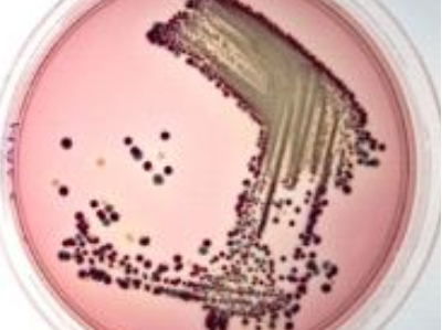 Gıdalarda Escherichia Coli O 157 aranması Gıdalarda Escherichia Coli O 157 aranması
