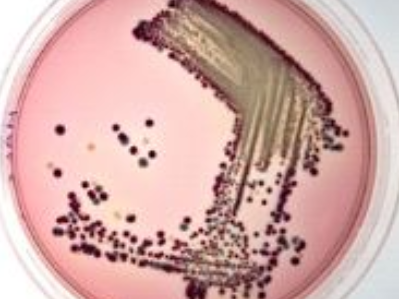 Gıdalarda Escherichia Coli O 157 aranması 