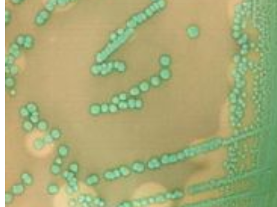 Gıdalarda Listeria Monocytogenes Aranması Gıdalarda Listeria Monocytogenes Aranması