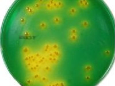 Gıdalarda Vibrio cholerae Vibro parahaemolyticus Aranması Gıdalarda Vibrio cholerae Vibro parahaemolyticus Aranması