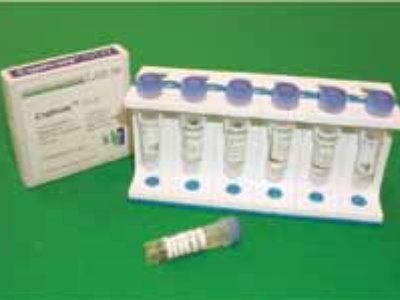 Gıdalarda Esherichia coli O157:H7 İzolasyonu ve İmmunomanyetik Seperasyon Gıdalarda Esherichia coli O157:H7 İzolasyonu ve İmmunomanyetik Seperasyon
