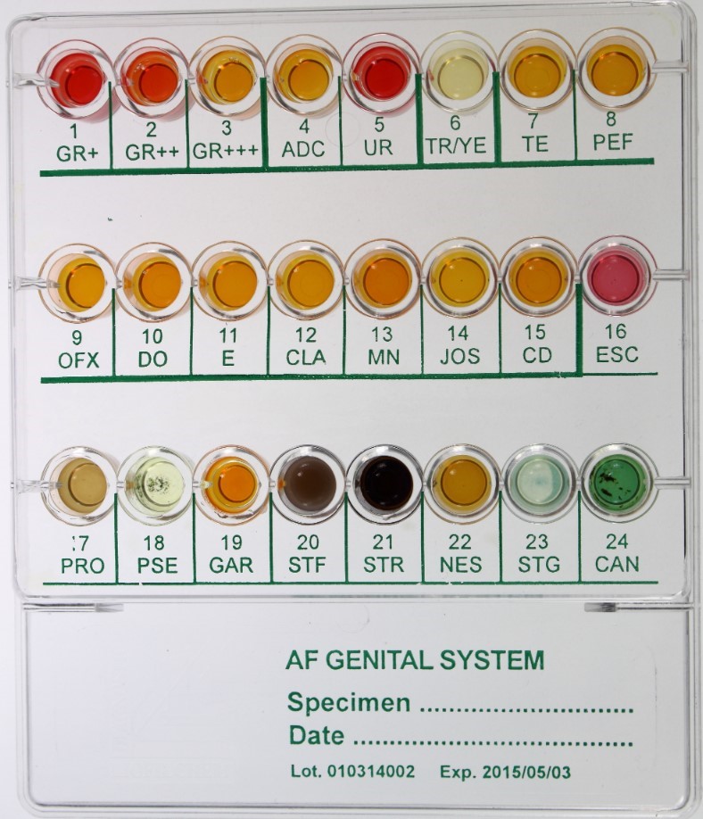 Test genitalis Mycoplasma Genitalium: