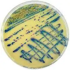 Kromojenik besiyerleri